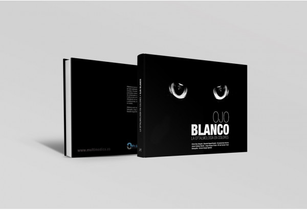Ojo blanco. La oftalmologí­a en colores -Manuales prácticos