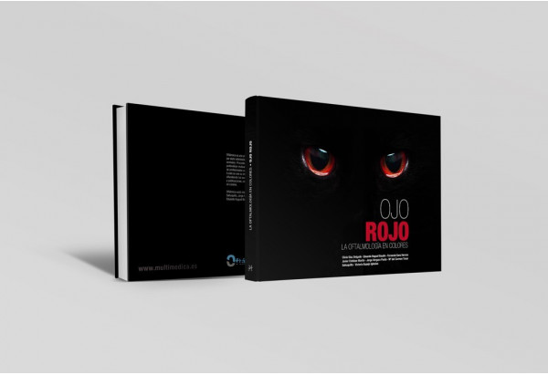 Ojo rojo. La oftalmologí­a en colores -Manuales prácticos