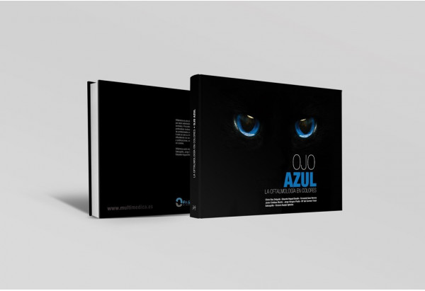 Ojo azul. La oftalmologí­a en colores -Manuales prácticos