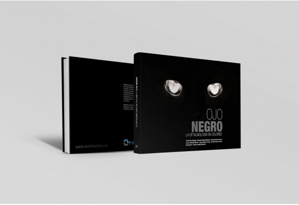 Ojo negro. La oftalmologí­a en colores -Manuales prácticos